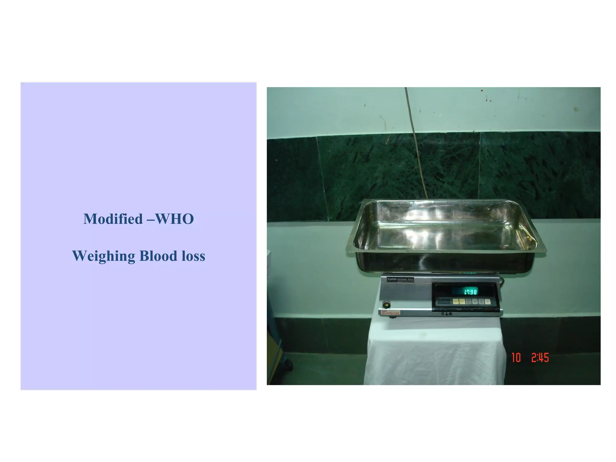 Modified –WHO

Weighing Blood loss
 