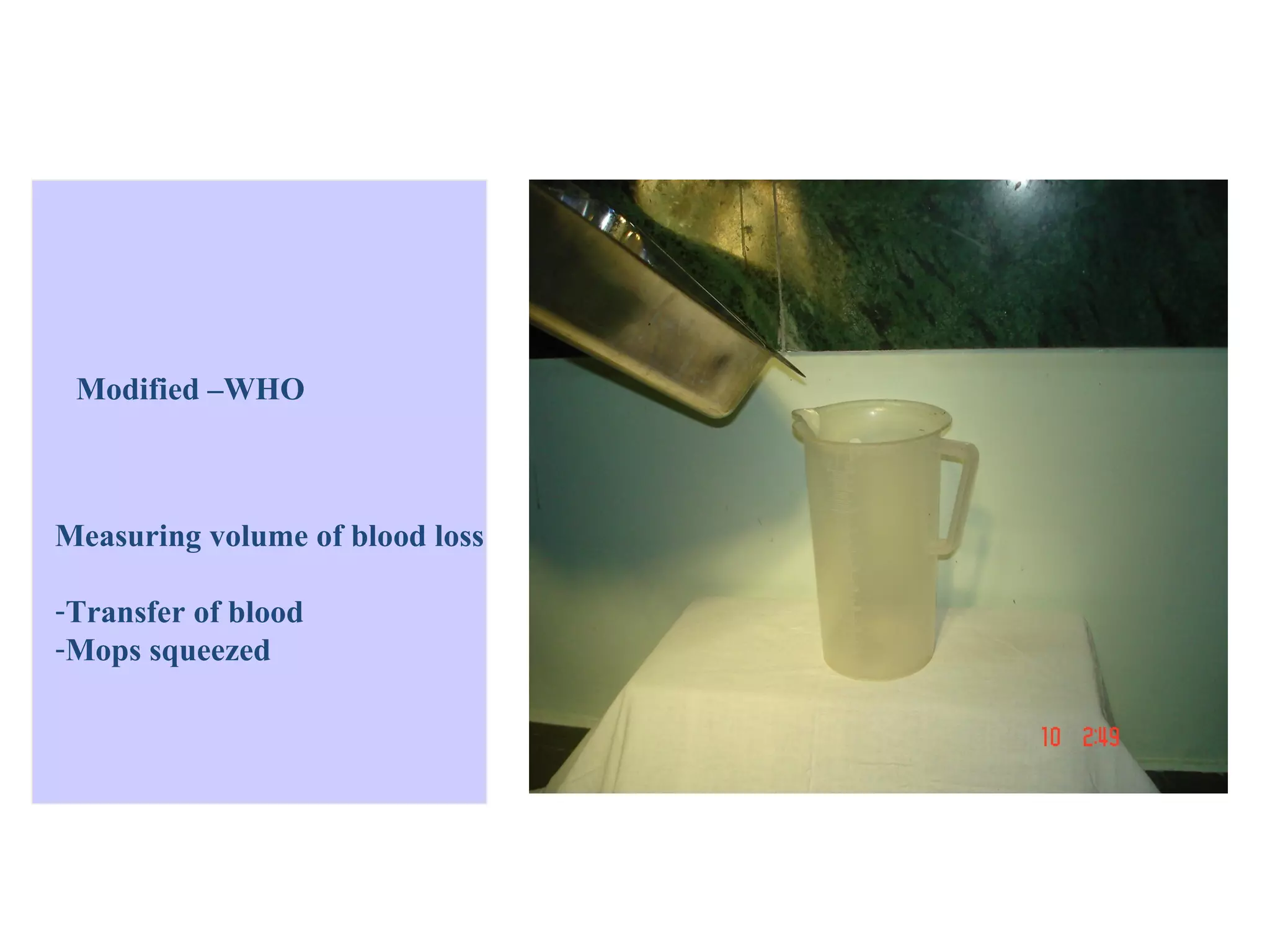 Modified –WHO



Measuring volume of blood loss

-Transfer of blood
-Mops squeezed
 