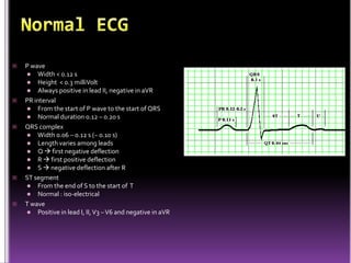    P wave
     Width < 0.12 s
     Height < 0.3 milliVolt
     Always positive in lead II, negative in aVR
   PR interval
     From the start of P wave to the start of QRS
     Normal duration 0.12 – 0.20 s
   QRS complex
     Width 0.06 – 0.12 s (~ 0.10 s)
     Length varies among leads
     Q  first negative deflection
     R  first positive deflection
     S  negative deflection after R
   ST segment
     From the end of S to the start of T
     Normal : iso-electrical
   T wave
     Positive in lead I, II, V3 – V6 and negative in aVR
 