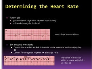  Rule of 300
   300/[number of large boxes between two R waves].
   only works for regular rhythms !!




                                                  300/7.5 large boxes = rate 40




   Six second methods
       Count the number of R-R intervals in six seconds and multiply by
        10
       Useful for irregular rhythm  average rate

                                                         There are 8 R-R intervals
                                                         within 30 boxes. Multiply 8 x
                                                         10 = Rate 80
 