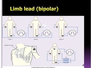-       +/-




    +
 