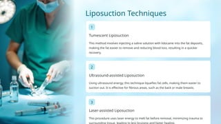 Liposuction Method Overview of Aesthetic & Plastic Surgery....pptx