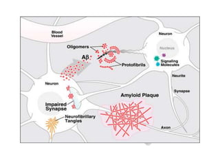 Overview of Alzheimer's disease | PPT
