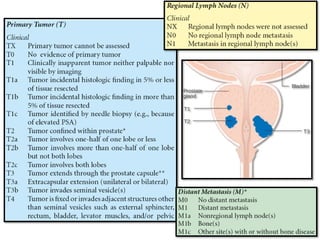 Prostate Cancer Inheritance Patterns Overview of Carcinoma Prostate and Genetics | PPTX