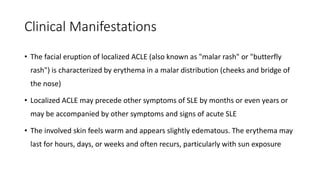 Lupus Rash Distribution Overview of Cutaneous Lupus.pptx