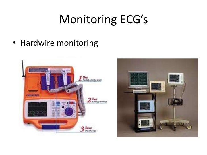 Overview of ecg part 1