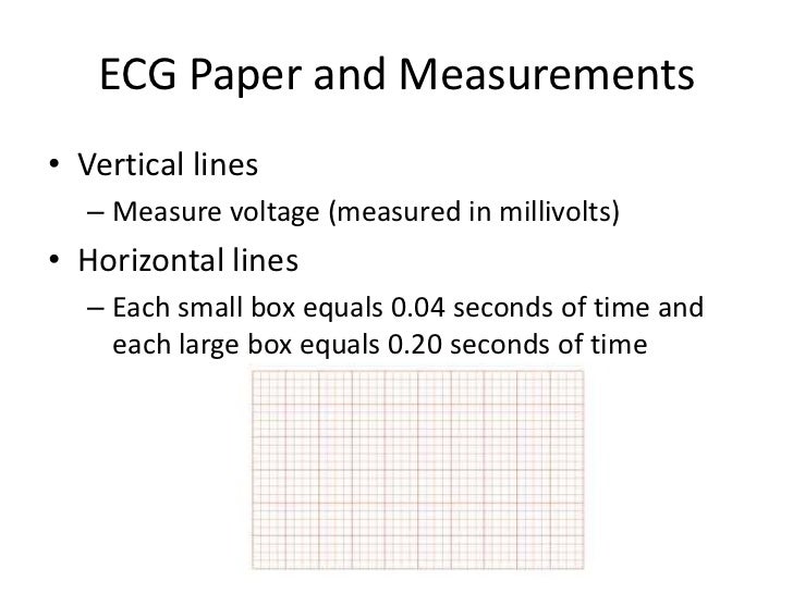overview of ecg part 1 ekg graph paper