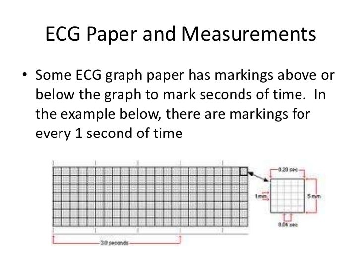overview of ecg part 1 small box graph paper