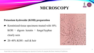 Overview of Fungal Infections[1].ppt pptx | PPTX