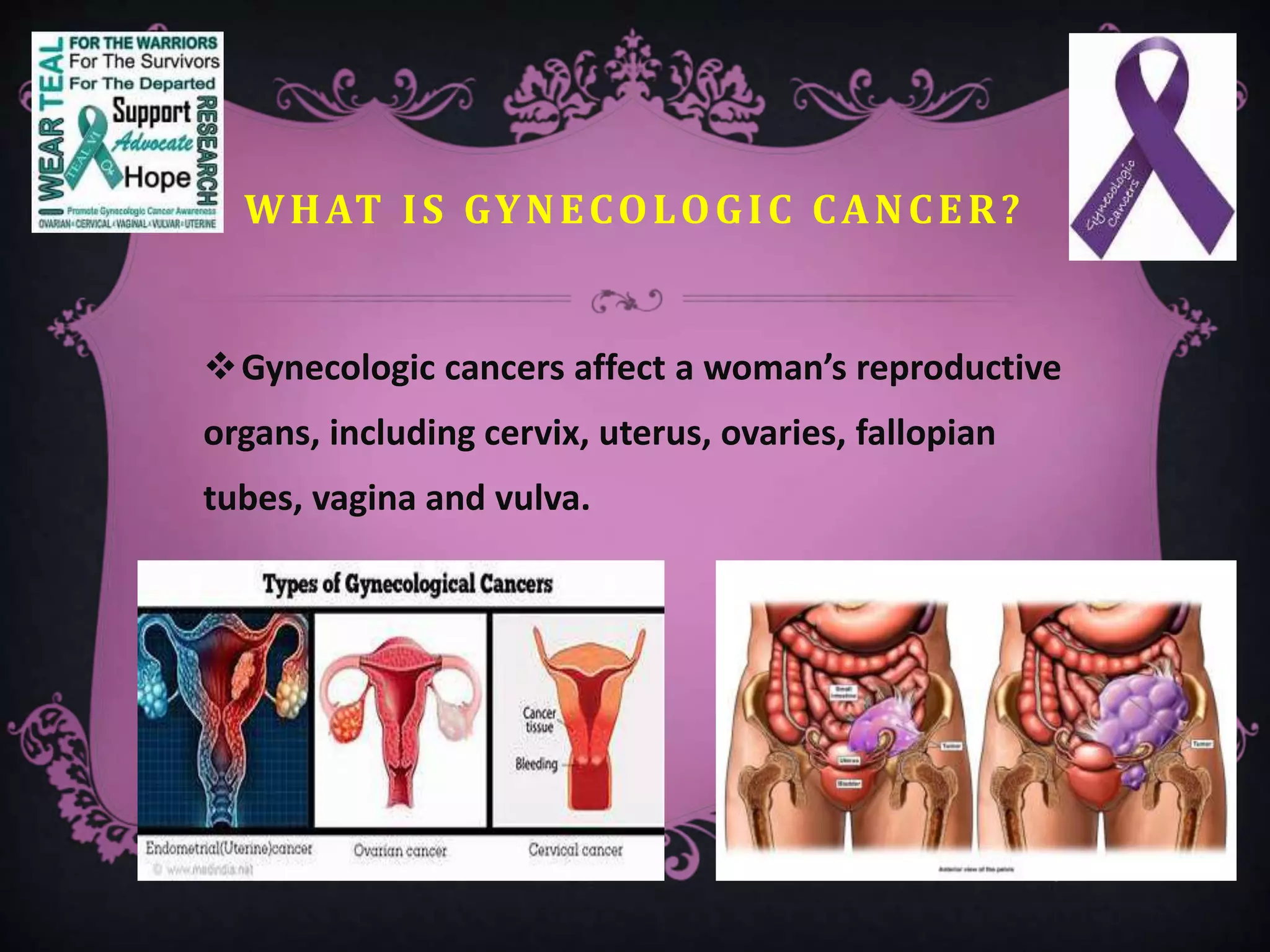 WHAT IS GYNECOLOGIC CANCER?
Gynecologic cancers affect a woman’s reproductive
organs, including cervix, uterus, ovaries, fallopian
tubes, vagina and vulva.
 