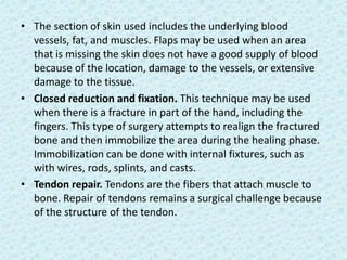 Terminalization Finger Overview of hand surgery | PPTX