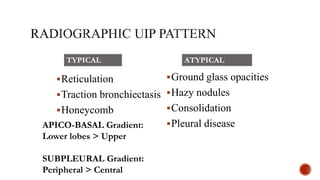 Typical Reticulation Line Overview of interstitial lung diseases | PPTX