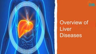 Overview of
Liver
Diseases
 