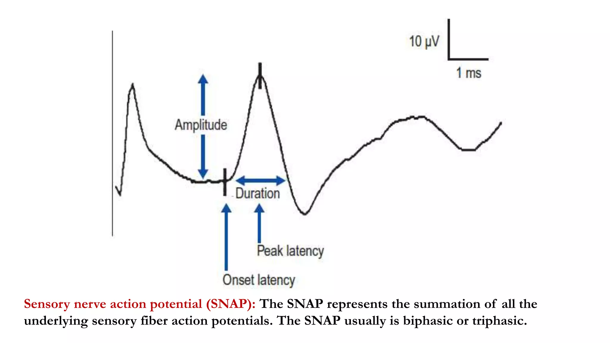 Triphasic Action Potential Overview of Nerve Conduction Study | PPTX