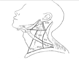 Vii Neck Dissection Overview Of Neck Dissections | PPT