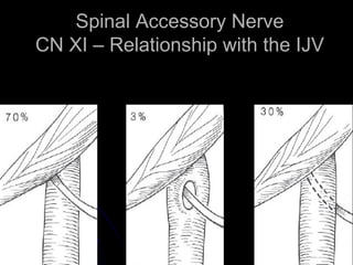 Spinal Accessory Nerve CN XI – Relationship with the IJV 