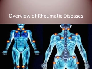 Overview of Rheumatic Diseases
 