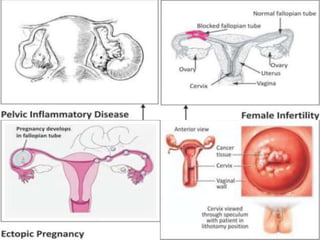 Sti Problem Overview of STI | PPTX