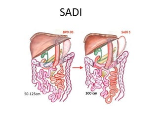 SADI
300 cm50-125cm
 