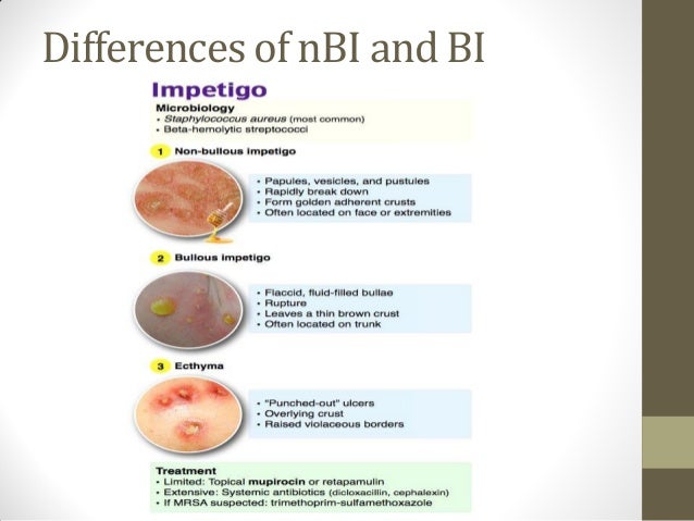 Overview Skin Disease And Impetigo Ping