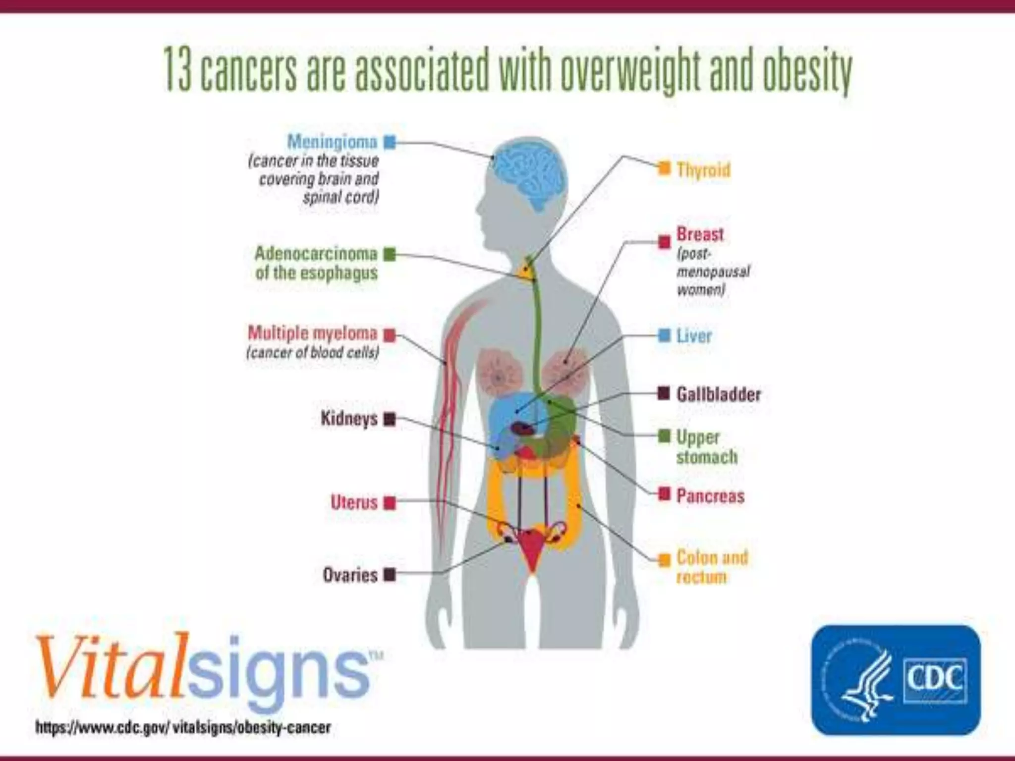 Over Weight Health Risks Overweight and obesity in adults health consequences | PPTX