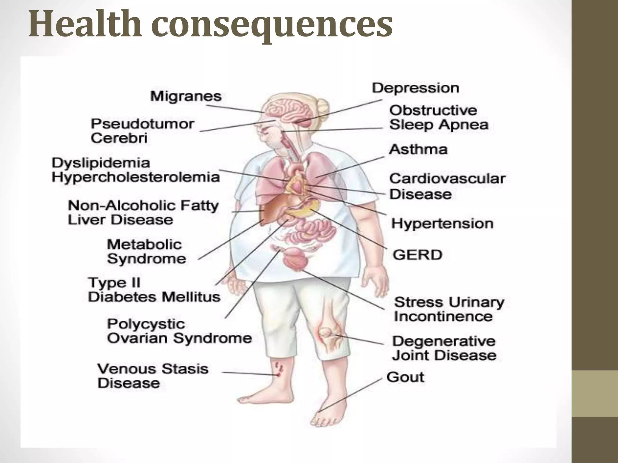 Over Weight Health Risks Overweight and obesity in adults health consequences | PPTX