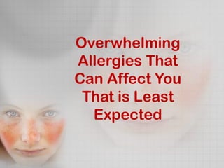 Overwhelming
Allergies That
Can Affect You
 That is Least
  Expected
 