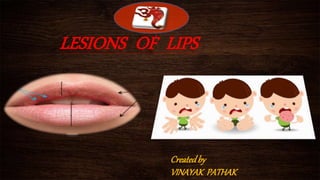 LESIONS OF LIPS
Createdby
VINAYAK PATHAK
 