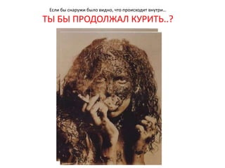 Является фактором для злокачественных опухолей желудочно – кишечного тракта, гинекологической сферы.