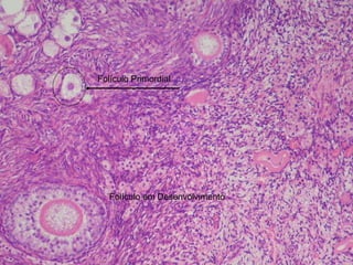 Folículo em Desenvolvimento Folículo Primordial 
