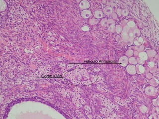 Corpo lúteo Folículo Primordial 