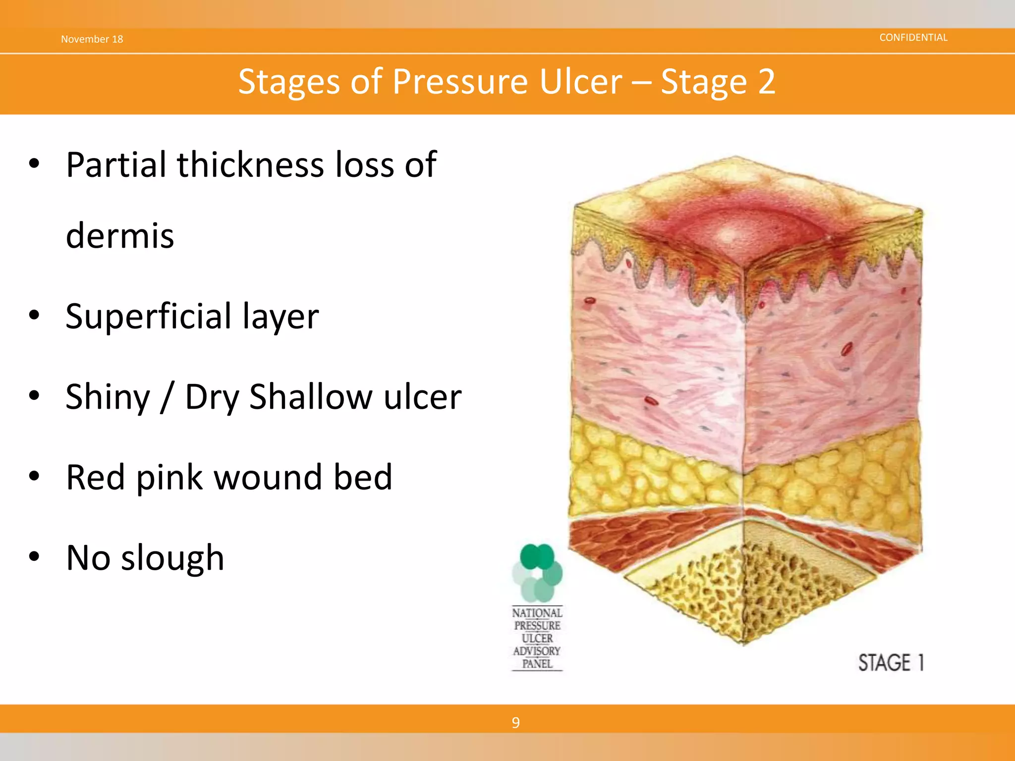 CONFIDENTIAL
• Partial thickness loss of
dermis
• Superficial layer
• Shiny / Dry Shallow ulcer
• Red pink wound bed
• No slough
November 18
9
Stages of Pressure Ulcer – Stage 2
 
