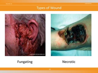 CONFIDENTIALNovember 18
19
Types of Wound
Fungating Necrotic
 