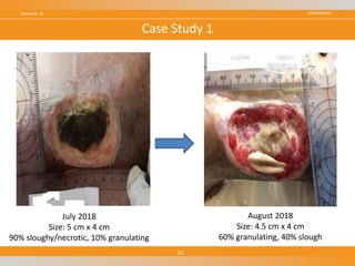 CONFIDENTIALNovember 18
23
Case Study 1
July 2018
Size: 5 cm x 4 cm
90% sloughy/necrotic, 10% granulating
August 2018
Size: 4.5 cm x 4 cm
60% granulating, 40% slough
 