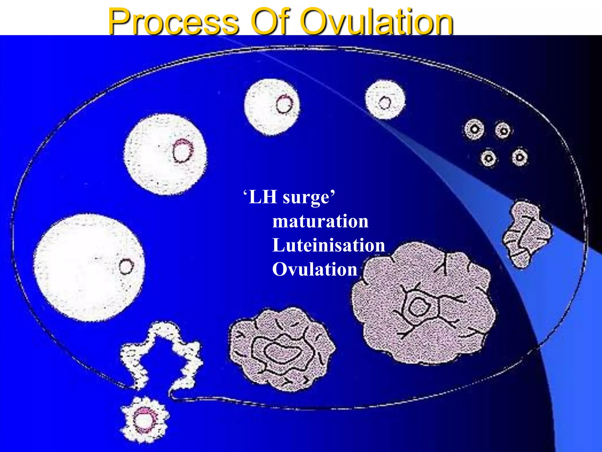 Process Of Ovulation
‘LH surge’
maturation
Luteinisation
Ovulation
 