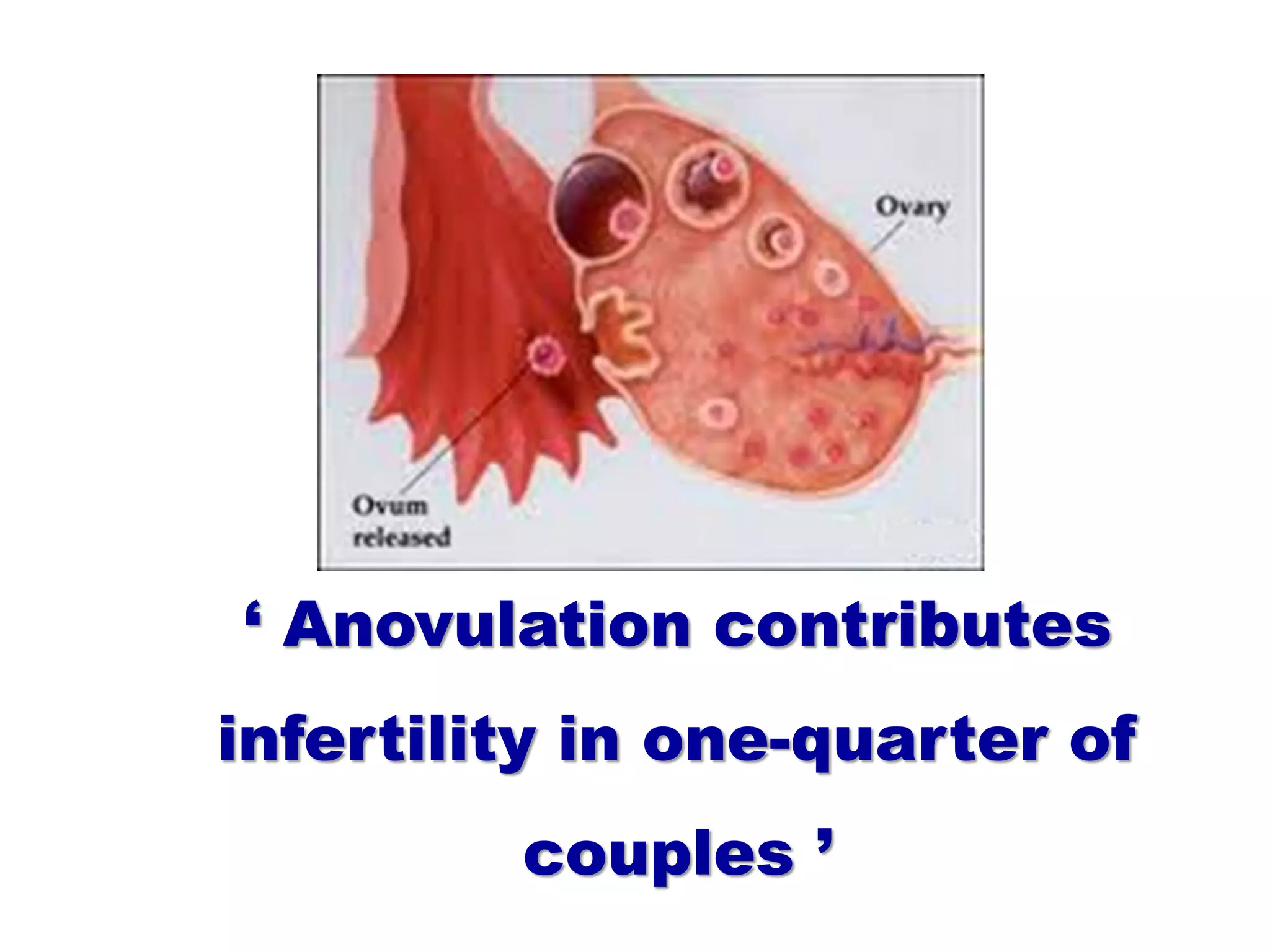 ‘ Anovulation contributes
infertility in one-quarter of
couples ’
 
