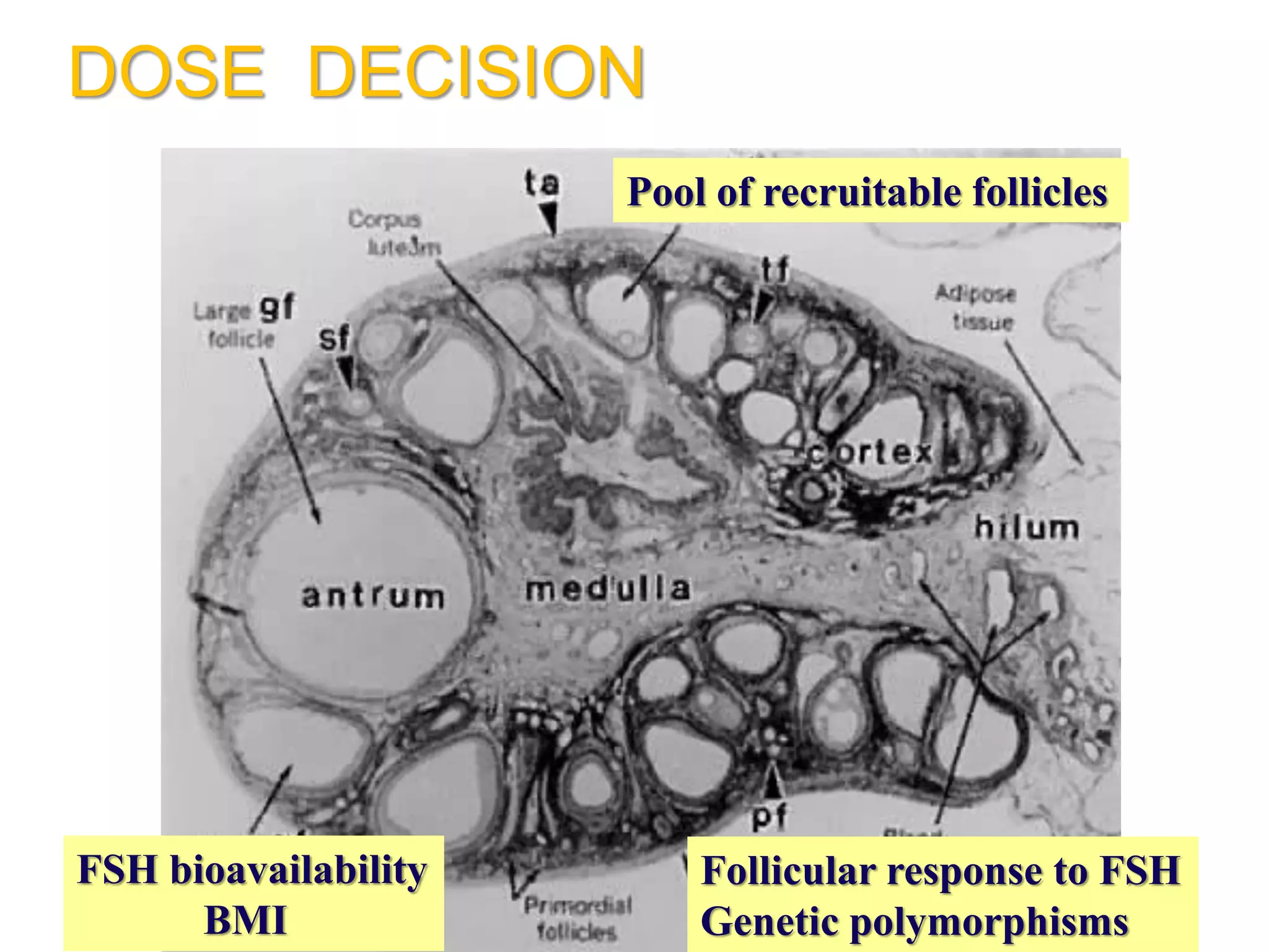 Pool of recruitable follicles
Follicular response to FSH
Genetic polymorphisms
FSH bioavailability
BMI
DOSE DECISION
 