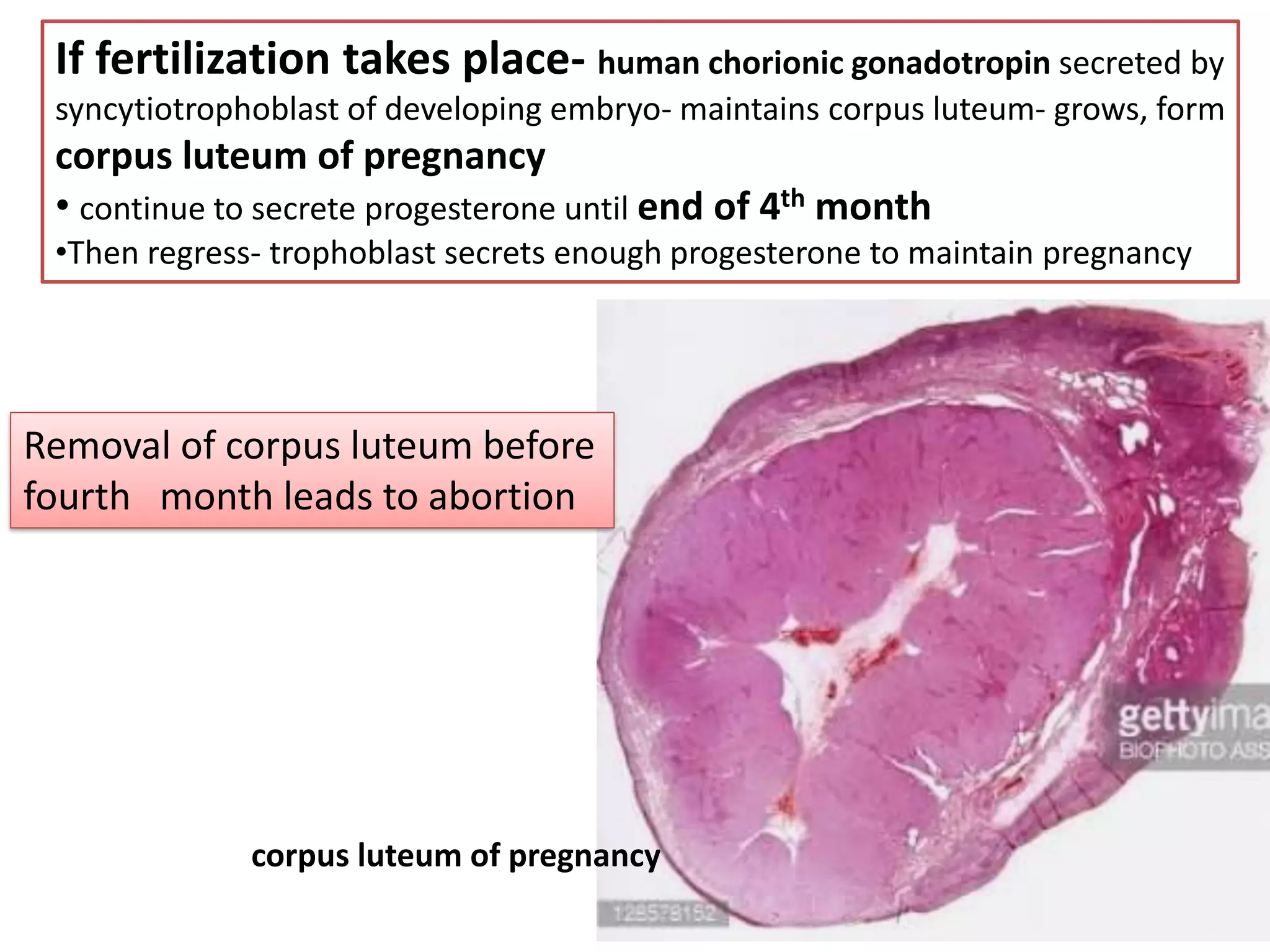 If fertilization takes place- human chorionic gonadotropin secreted by
syncytiotrophoblast of developing embryo- maintains corpus luteum- grows, form
corpus luteum of pregnancy
• continue to secrete progesterone until end of 4th month
•Then regress- trophoblast secrets enough progesterone to maintain pregnancy
Removal of corpus luteum before
fourth month leads to abortion
corpus luteum of pregnancy
 