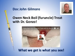 Owen Neck Boil (furuncle) Treat
with Dr. Gonzo!
What we get is what you see!
Doc John Gilmore
 