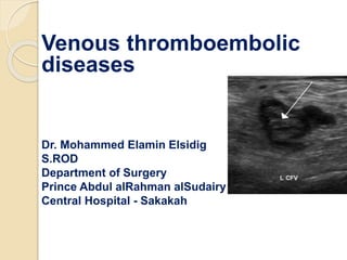 Venous thromboembolic
diseases
Dr. Mohammed Elamin Elsidig
S.ROD
Department of Surgery
Prince Abdul alRahman alSudairy
Central Hospital - Sakakah
 