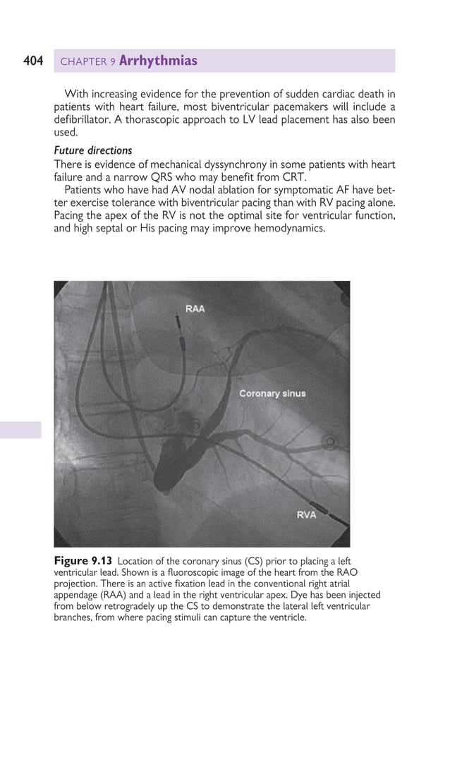 MWEBAZA VICTOR - Oxford American Handbook of Cardiology.pdf