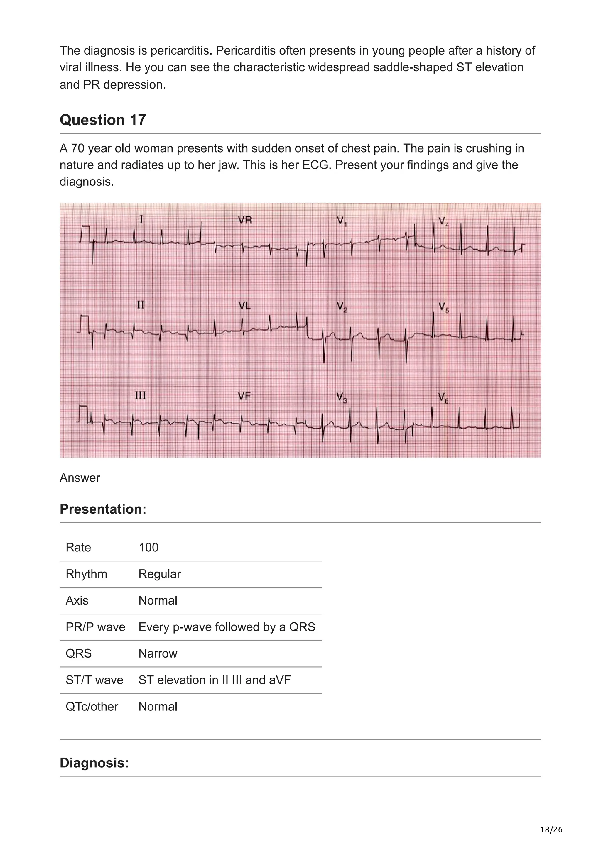 18/26
The diagnosis is pericarditis. Pericarditis often presents in young people after a history of
viral illness. He you can see the characteristic widespread saddle-shaped ST elevation
and PR depression.
Question 17
A 70 year old woman presents with sudden onset of chest pain. The pain is crushing in
nature and radiates up to her jaw. This is her ECG. Present your findings and give the
diagnosis.
Answer
Presentation:
Rate 100
Rhythm Regular
Axis Normal
PR/P wave Every p-wave followed by a QRS
QRS Narrow
ST/T wave ST elevation in II III and aVF
QTc/other Normal
Diagnosis:
 