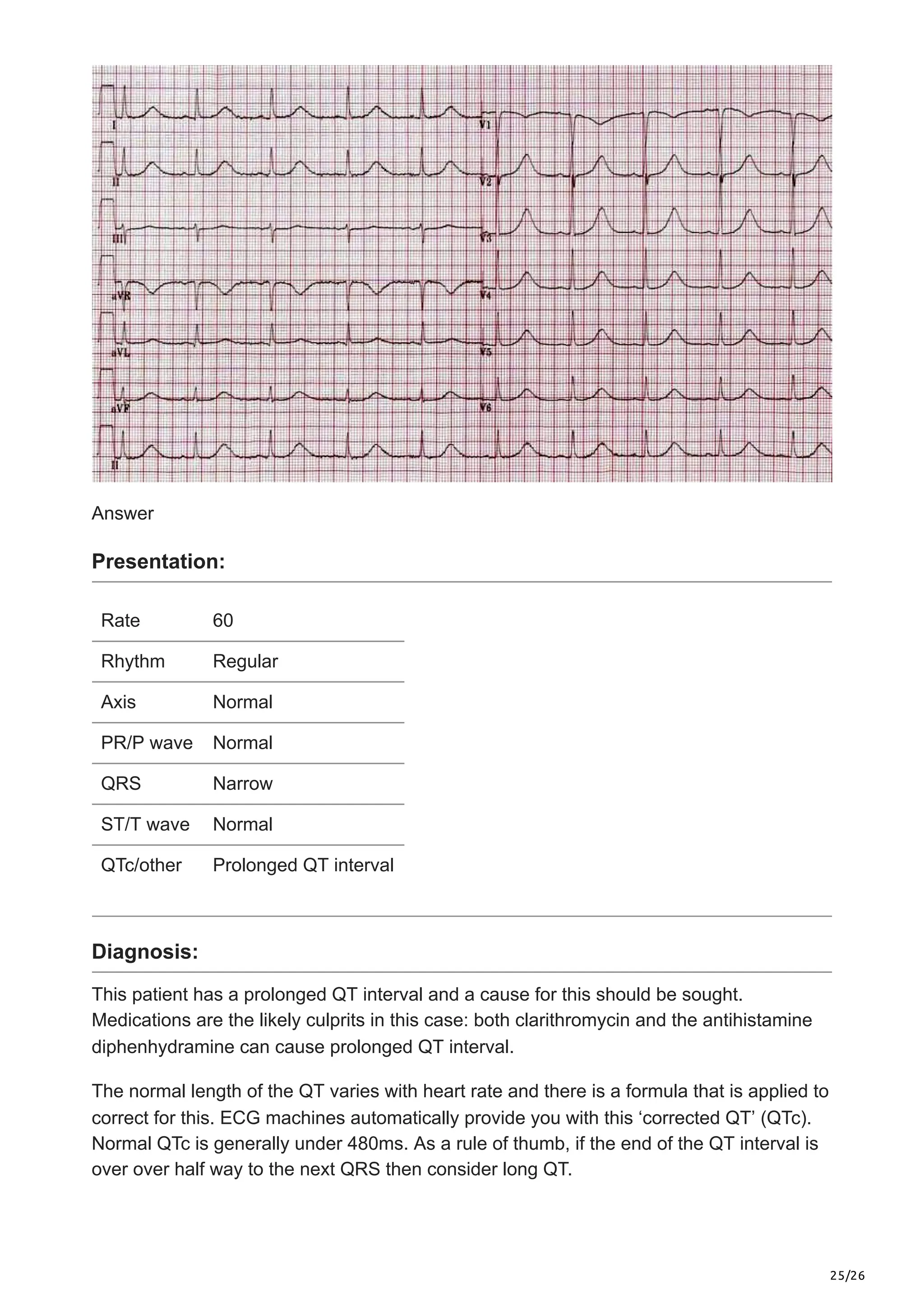 25/26
Answer
Presentation:
Rate 60
Rhythm Regular
Axis Normal
PR/P wave Normal
QRS Narrow
ST/T wave Normal
QTc/other Prolonged QT interval
Diagnosis:
This patient has a prolonged QT interval and a cause for this should be sought.
Medications are the likely culprits in this case: both clarithromycin and the antihistamine
diphenhydramine can cause prolonged QT interval.
The normal length of the QT varies with heart rate and there is a formula that is applied to
correct for this. ECG machines automatically provide you with this ‘corrected QT’ (QTc).
Normal QTc is generally under 480ms. As a rule of thumb, if the end of the QT interval is
over over half way to the next QRS then consider long QT.
 