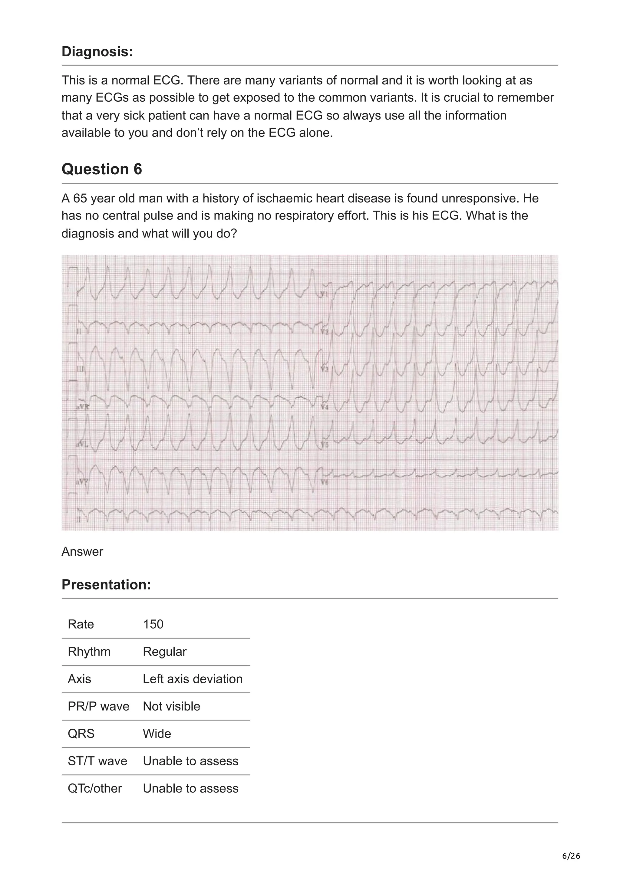 6/26
Diagnosis:
This is a normal ECG. There are many variants of normal and it is worth looking at as
many ECGs as possible to get exposed to the common variants. It is crucial to remember
that a very sick patient can have a normal ECG so always use all the information
available to you and don’t rely on the ECG alone.
Question 6
A 65 year old man with a history of ischaemic heart disease is found unresponsive. He
has no central pulse and is making no respiratory effort. This is his ECG. What is the
diagnosis and what will you do?
Answer
Presentation:
Rate 150
Rhythm Regular
Axis Left axis deviation
PR/P wave Not visible
QRS Wide
ST/T wave Unable to assess
QTc/other Unable to assess
 