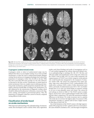 Small Deep Cryptogenic Infarct Oxford textbook of stroke and cerebrovascular disease ( PDFDrive ).pdf