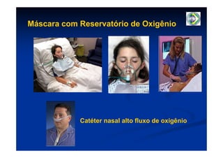 Máscara com Reservatório de Oxigênio




            Catéter nasal alto fluxo de oxigênio
 