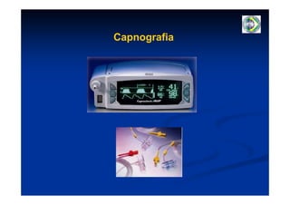 Capnografia
 