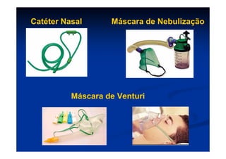 Catéter Nasal      Máscara de Nebulização




          Máscara de Venturi
 