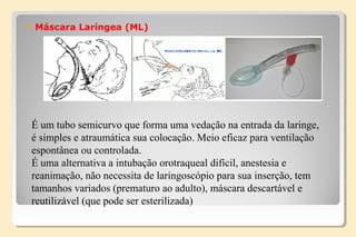 Máscara Laríngea (ML)
É um tubo semicurvo que forma uma vedação na entrada da laringe,
é simples e atraumática sua colocação. Meio eficaz para ventilação
espontânea ou controlada.
É uma alternativa a intubação orotraqueal difícil, anestesia e
reanimação, não necessita de laringoscópio para sua inserção, tem
tamanhos variados (prematuro ao adulto), máscara descartável e
reutilizável (que pode ser esterilizada)
 