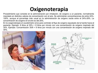 Oxigenoterapia
Procedimiento que consiste en la administración por inhalación, de oxígeno a un paciente, normalmente
mezclado en distintos valores de concentración con el aire. Se administran concentraciones de entre 24%-
100%, aunque el porcentaje más usual en la administración de oxígeno oscila entre el 24%-28%. La
concentración de oxígeno en el aire es del 20%.
En la oxigenoterapia el caudalímetro sirve para controlar el flujo de oxígeno expulsado de la fuente hacia el
paciente. Ejemplo: 8 litros al 35% = 8 litros por minuto con una concentración de oxígeno inspirado del
35%. Ejemplo: Concentración 35/8 = 8 litros por minuto con una concentración de oxígeno inspirado del
35%.
 